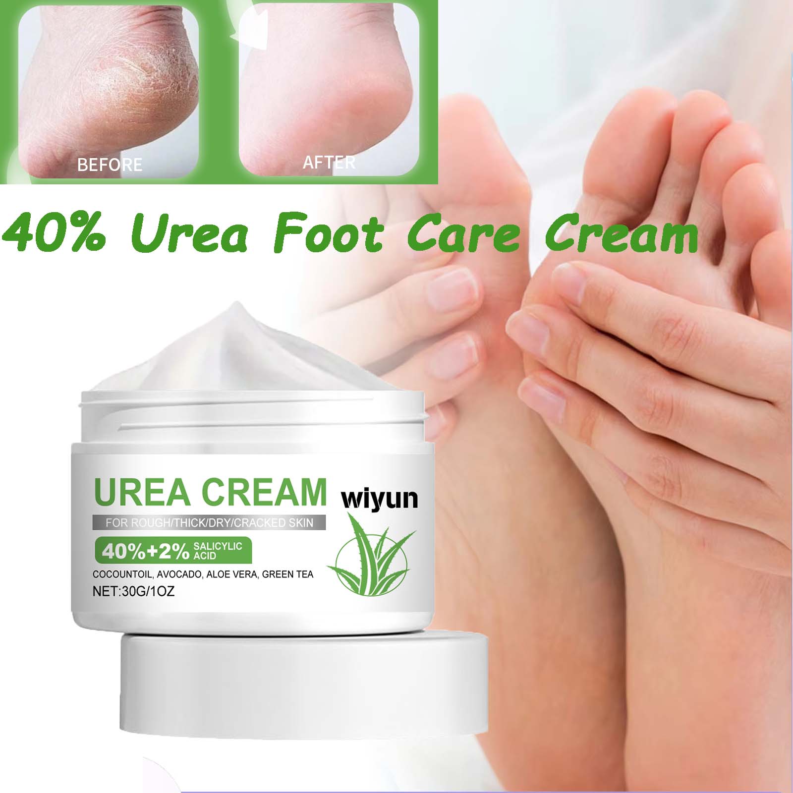 Urea Foot Cream - ครีมบำรุงเท้ายูเรีย 40% บำรุงผิวข้ามคืน ช่วยผลัดเซลล์ผิวที่ตายแล้ว บำรุงผิวแห้งแตก ซ่อมแซมส้นเท้าแตกและตาปลา