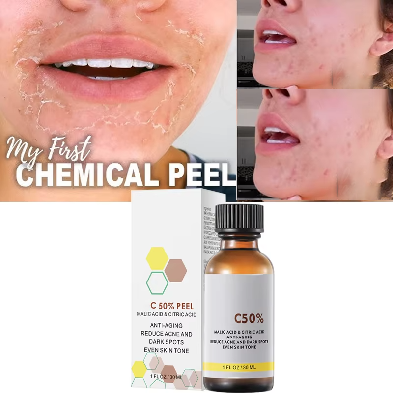 Licorice Root Extract - ด้วย Malic Acid และกรดซิตริกสําหรับ Face Facial