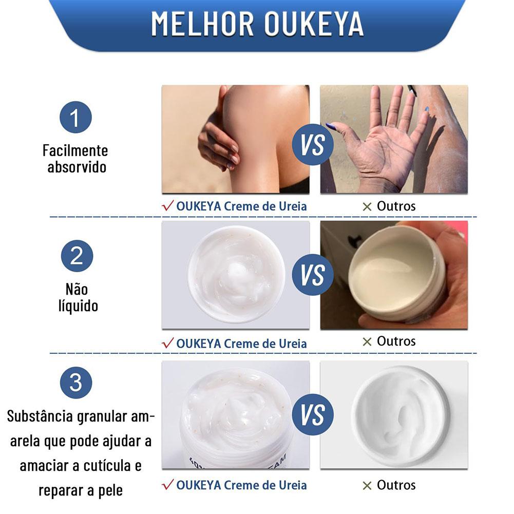 ยูเรียครีม 40% มอยส์เจอร์ไรเซอ - Urea Foot Cream บทวิจารณ์และราคา
