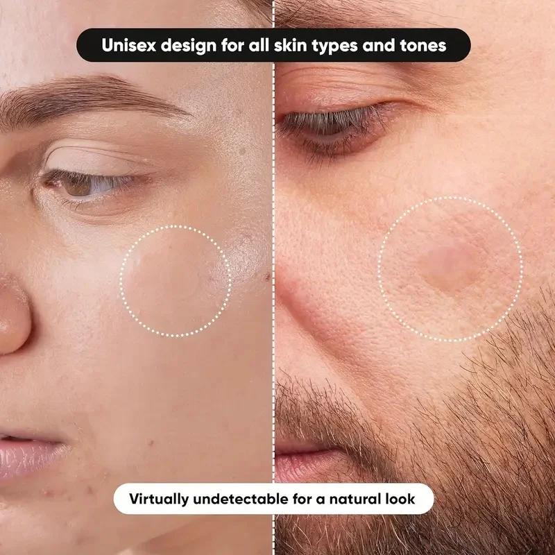 แผ่นแปะสิว 360 ชิ้น/กล่อง - ปร - Skincare The Originote บทวิจารณ์และราคา