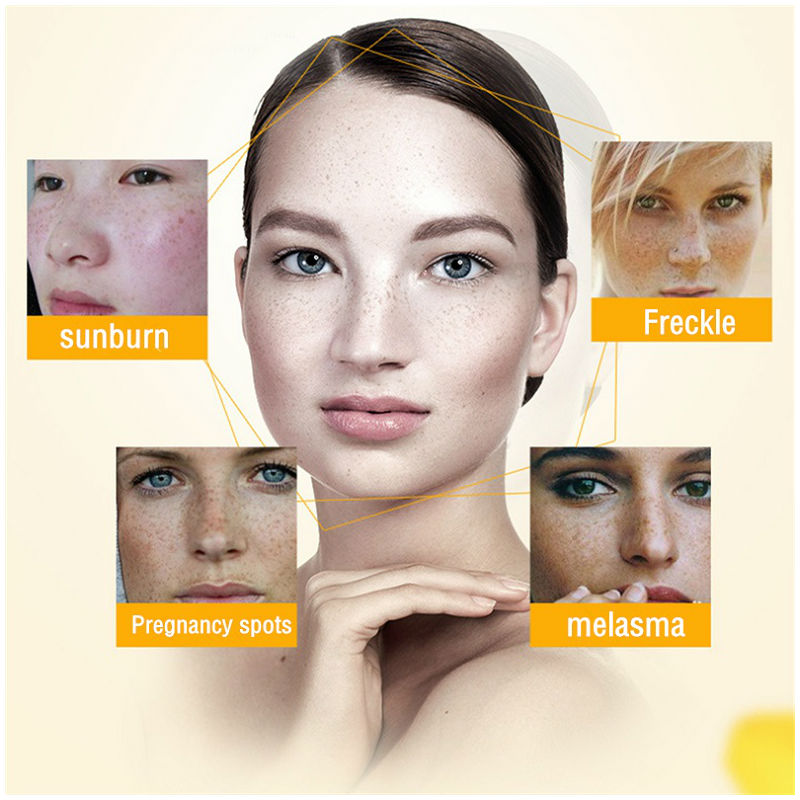 Dimollaure Whitening Freckle C - Skincare Retinol บทวิจารณ์และราคา