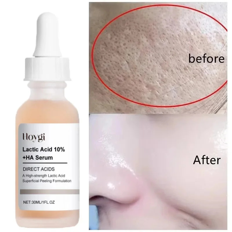 Lactic Acid Shrink Pores Serum - Licorice Root Extract บทวิจารณ์และราคา